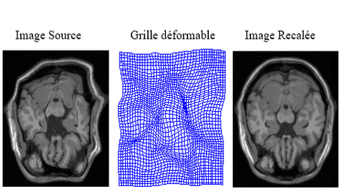 Medical Image Processing